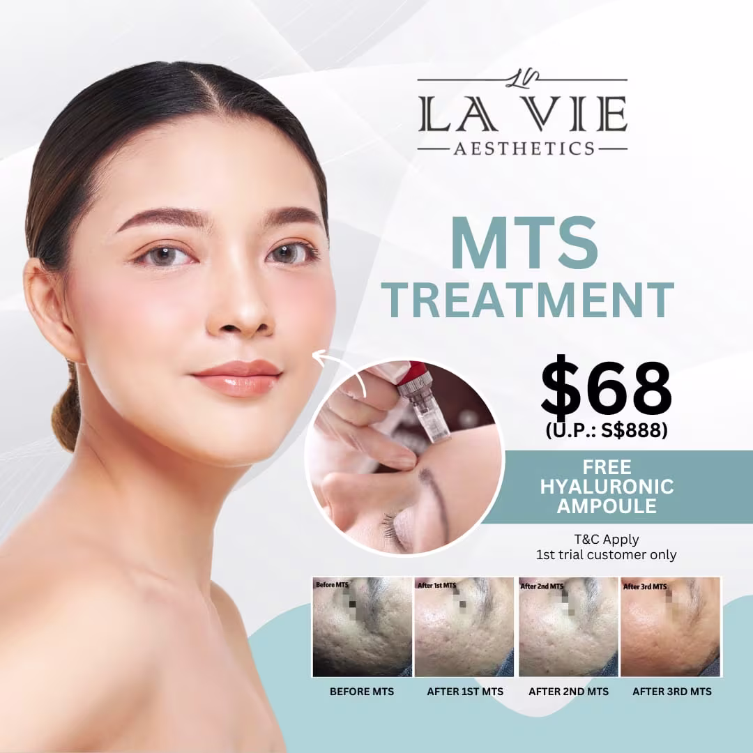 Mts Promo